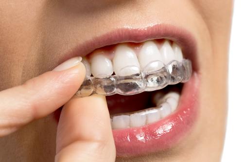 Cabinet d'orthodontie du Dr Ahmed Bouaoune