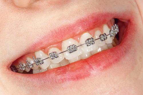 Cabinet d'orthodontie du Dr Ahmed Bouaoune
