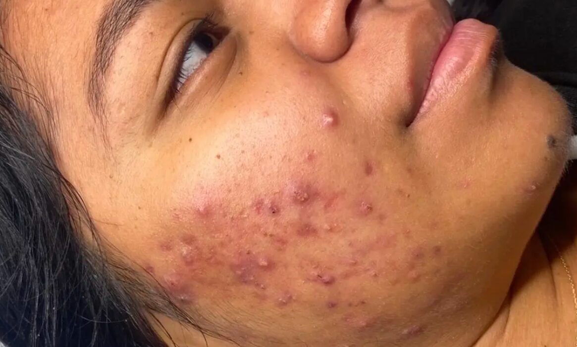 Skin Glow Muret