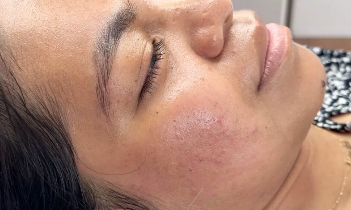 Skin Glow Muret