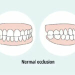 Occlusion de la mâchoire et sommeil : pourquoi votre matelas joue un rôle essentiel